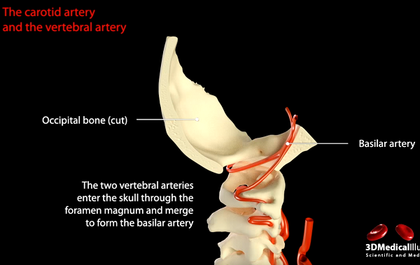 Анатомическая извитость позвоночной артерии. 3D модель